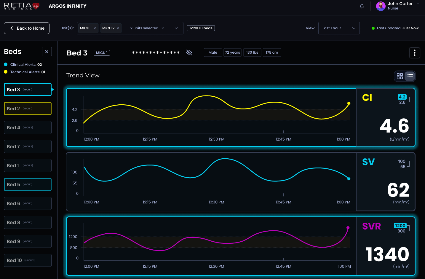 Argos Infinity single patient trend view