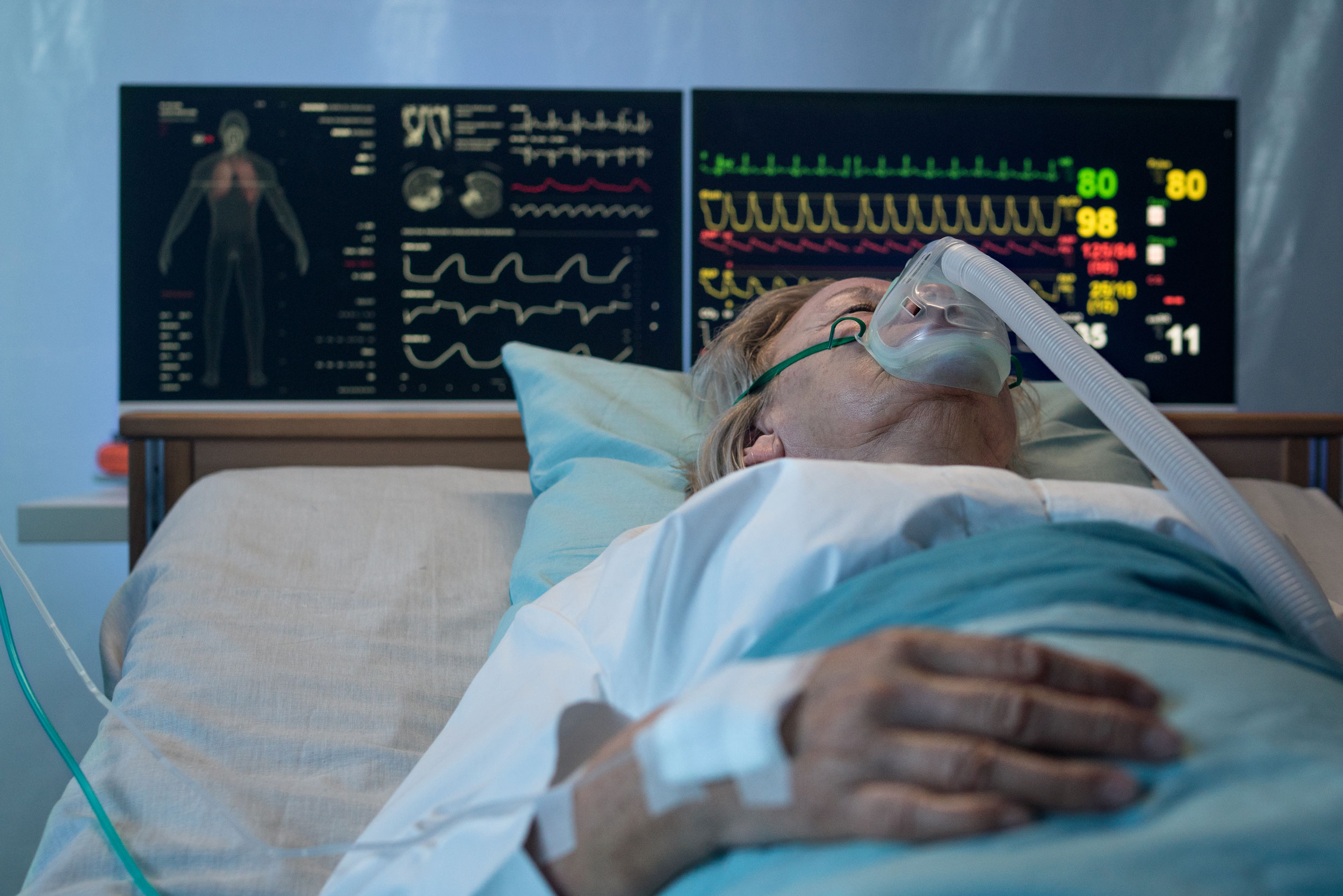 Intensive Care Units